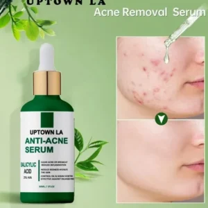 Uptown La Anti Acne Face Serum