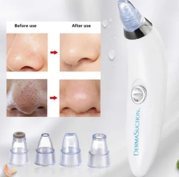 Dead Skin Removal Derma Suctio - Image 3