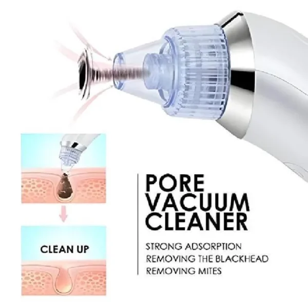 Dead Skin Removal Derma Suctio - Image 5