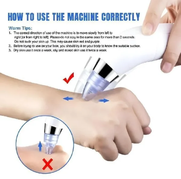 Dead Skin Removal Derma Suctio - Image 6