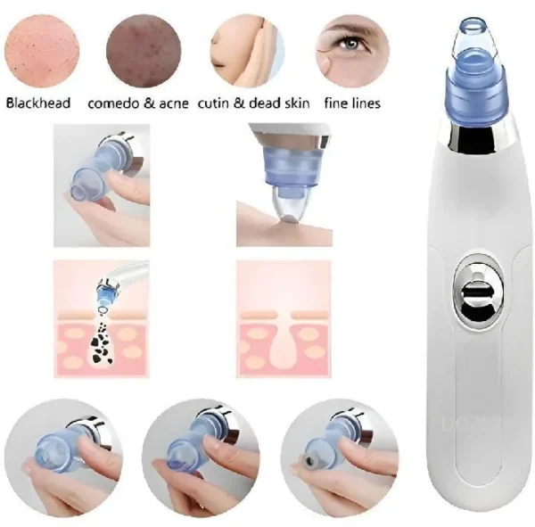 Dead Skin Removal Derma Suctio - Image 8
